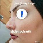 دکتر لیلا شریفی در شیراز