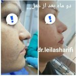 دکتر لیلا شریفی در شیراز