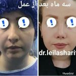 دکتر لیلا شریفی در شیراز