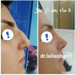 دکتر لیلا شریفی در شیراز