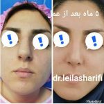 دکتر لیلا شریفی در شیراز