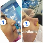 دکتر لیلا شریفی در شیراز