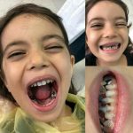 دکتر راضیه بیرانوند در نوشهر