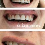 دکتر راضیه بیرانوند در نوشهر