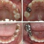 دکتر راضیه بیرانوند در نوشهر