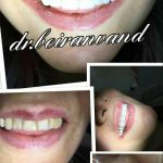 دکتر راضیه بیرانوند در نوشهر