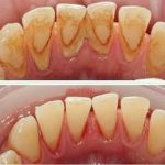 دکتر راضیه بیرانوند در نوشهر