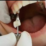 دکتر آرش ابراهیمی