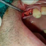 دکتر آرش ابراهیمی