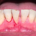 دکتر زهرا علیزاده طبری در تهران