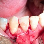 دکتر زهرا علیزاده طبری در تهران