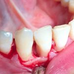 دکتر زهرا علیزاده طبری در تهران