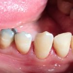 دکتر زهرا علیزاده طبری در تهران