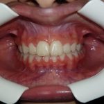 دکتر حمیدرضا مشکانی در بروجرد