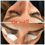 کلینیک کاشت ناخن زن در ارومیه