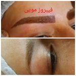 کلینیک کاشت ناخن زن در ارومیه