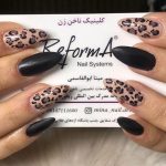 کلینیک کاشت ناخن زن در ارومیه