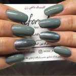 کلینیک کاشت ناخن زن در ارومیه