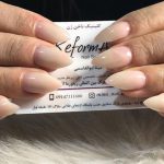 کلینیک کاشت ناخن زن در ارومیه