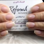 کلینیک کاشت ناخن زن در ارومیه