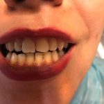 دکتر پیمان دخت پرتوی در تهران