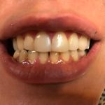 دکتر پیمان دخت پرتوی در تهران