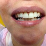 دکتر پیمان دخت پرتوی در تهران