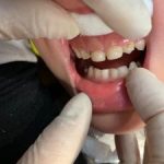 دکتر مریم رفیعی دندانپزشک در قم