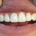 دکتر عبدالرضا محمدی در تهران