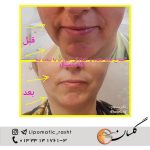 مرکز پوست زیبایی و لیزر دکتر مرتضی دستیار در رشت