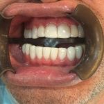 دکتر عبدالرضا محمدی در تهران