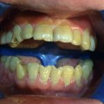 دکتر عبدالرضا محمدی در تهران