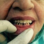 دکتر عبدالرضا محمدی در تهران