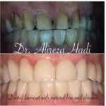 مرکز دندانپزشکی دکتر علیرضا هادی