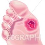 مرکز سلامت پا دیابتی دکتر خسروی در کرج