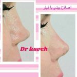 دکتر فرهاد کاوه در کرج