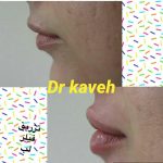 دکتر فرهاد کاوه در کرج