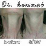 دکتر سیف اله همت در تهران