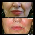 دکتر سیف اله همت در تهران