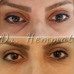 دکتر سیف اله همت در تهران