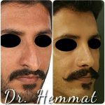 دکتر سیف اله همت در تهران