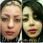 دکتر سیف اله همت در تهران