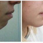 دکتر سیف اله همت در تهران