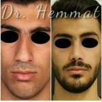 دکتر سیف اله همت در تهران