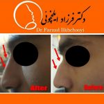 دکتر فرزاد ایلخچوئی در تبریز