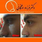 دکتر فرزاد ایلخچوئی در تبریز