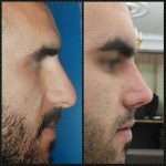 دکتر مجید احمدپور متخصص زیبایی در تهران