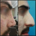 دکتر مجید احمدپور متخصص زیبایی در تهران