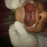 دکتر امیر هوشنگ رسولی نژاد دندانپزشک در کرج