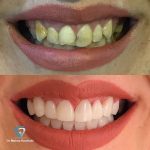 بهترین دندانپزشک زیبایی دکتر مهسا کوکبی در شیراز